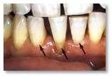 dobry dentysta Stargard ortodonta Stargard wybielanie zębów Stargard