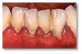 kwas hialuronowy Stargard wybielanie zębów Stargard ortodonta Stargard.