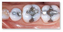 Dobry dentysta Stargard wybielanie zębów Stargard, dobry stomatolog Stargard