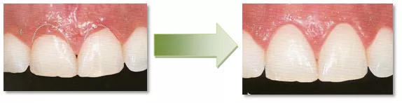 Wybielanie zębów Stargard dobry stomatolog dentysta ortodonta chirurg Stargard