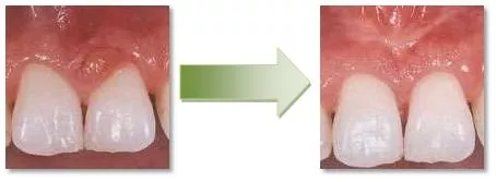 Dobry stomatolog Stargard dobry dentysta Stargard wybielanie zębów Stargard