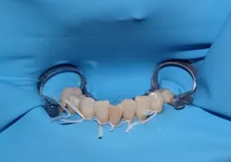 endodoncja stargard