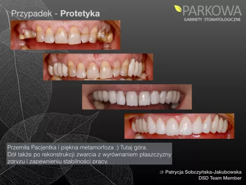Galeria Przemian - Protetyka