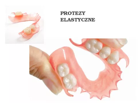 Czym charakteryzują się protezy elastyczne?