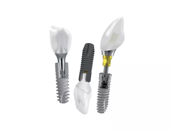 Czym są implanty zębowe? 