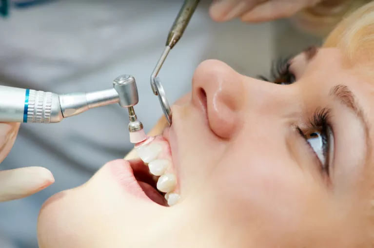 Czyszczenie zębów u dentysty